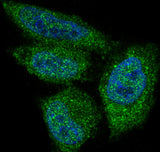 Anti-AKT1 Monoclonal Antibody Boster Bio