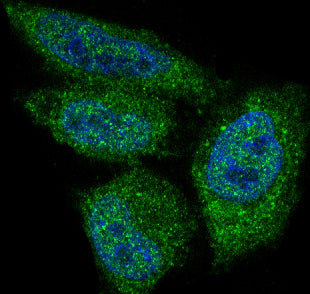 Anti-AKT1 Monoclonal Antibody Boster Bio