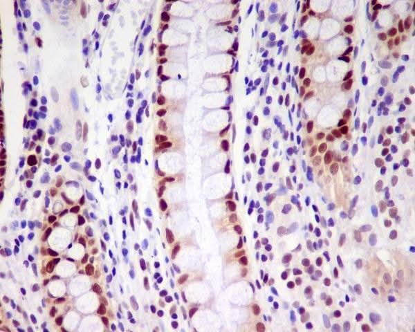 Anti-PCNA Rabbit Monoclonal Antibody Boster Bio
