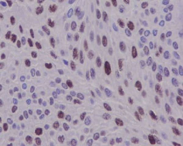 Anti-Cyclin D1 CCND1 Rabbit Monoclonal Antibody Boster Bio