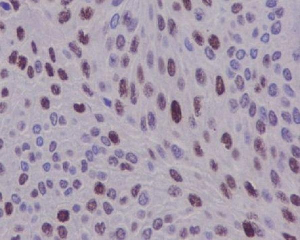 Anti-Cyclin D1 CCND1 Rabbit Monoclonal Antibody Boster Bio