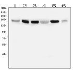 Anti-IRS1 Antibody Picoband® (monoclonal, 10I3 Boster Bio