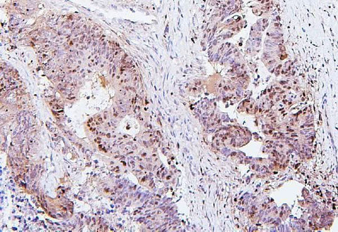 Anti-SQSTM1/p62 Antibody Picoband® (monoclonal, 3H11 Boster Bio
