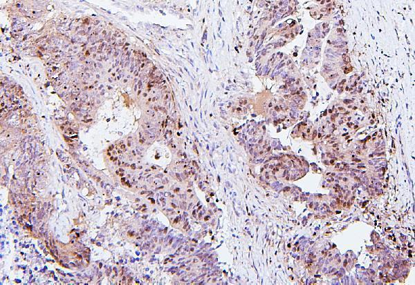 Anti-SQSTM1/p62 Antibody Picoband® (monoclonal, 3H11 Boster Bio