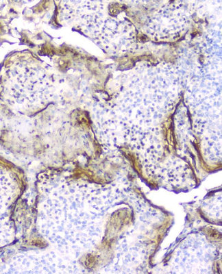 Anti-Elafin/Skalp PI3 Antibody (monoclonal, C7 Boster Bio