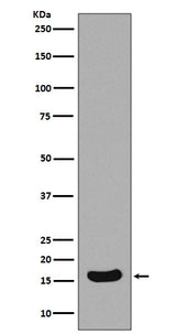 Anti-Survivin Birc5 Rabbit Monoclonal Antibody Boster Bio