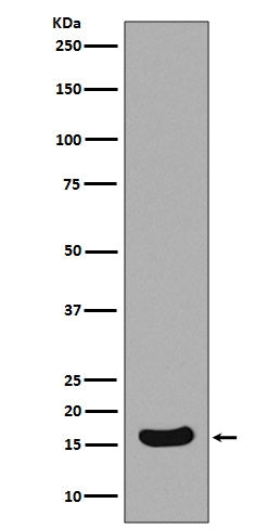 Anti-Survivin Birc5 Rabbit Monoclonal Antibody Boster Bio