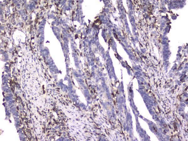 Anti-CD18 ITGB2 Antibody Picoband® (monoclonal, 1A3/2A10 Boster Bio