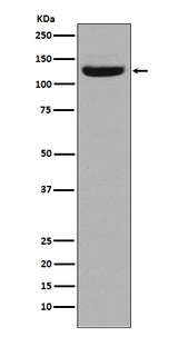 Anti-Collagen I COL1A1 Rabbit Monoclonal Antibody Boster Bio
