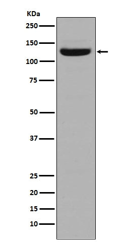 Anti-Collagen I COL1A1 Rabbit Monoclonal Antibody Boster Bio