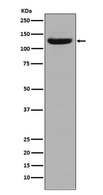 Anti-Collagen I COL1A1 Rabbit Monoclonal Antibody Boster Bio