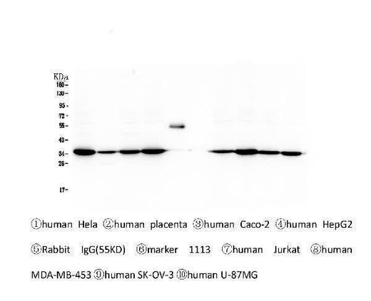 Anti-Emerin EMD Antibody Picoband® (monoclonal, 5A10 Boster Bio