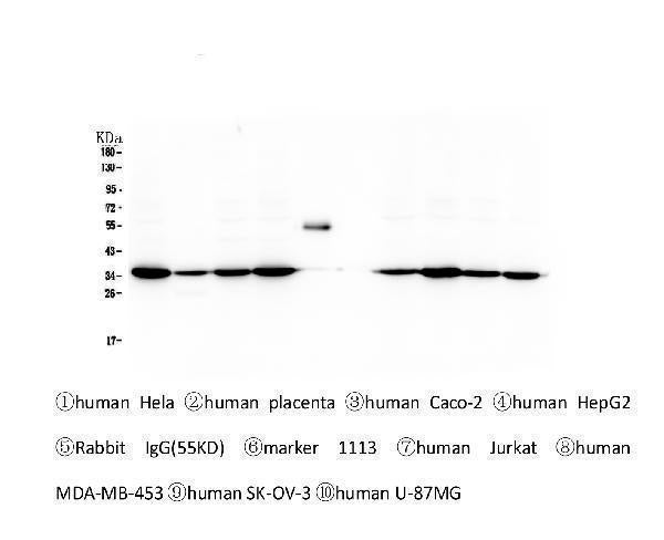 Anti-Emerin EMD Antibody Picoband® (monoclonal, 5A10 Boster Bio