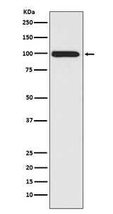 Anti-LRP1/Lrp 1 Cluster Ii Rabbit Monoclonal Antibody Boster Bio