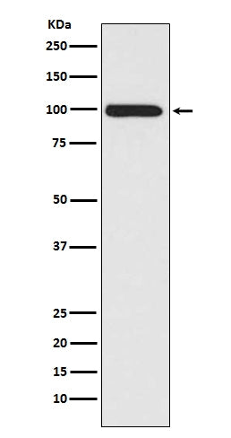 Anti-LRP1/Lrp 1 Cluster Ii Rabbit Monoclonal Antibody Boster Bio