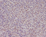 Anti-PMS2 Rabbit Monoclonal Antibody Boster Bio