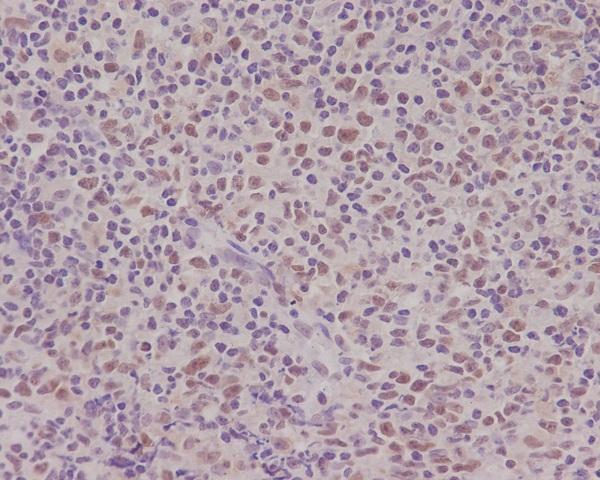 Anti-PMS2 Rabbit Monoclonal Antibody Boster Bio