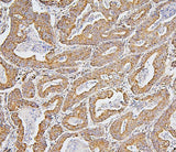 Anti-BAK/BAK1 Antibody Picoband® (monoclonal, 4C2 Boster Bio