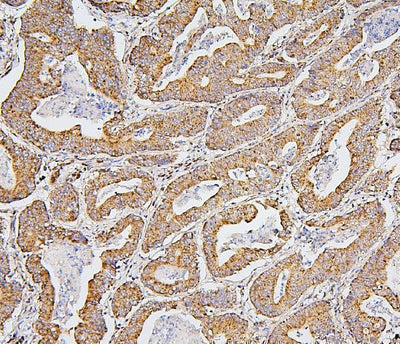Anti-BAK/BAK1 Antibody Picoband® (monoclonal, 4C2 Boster Bio
