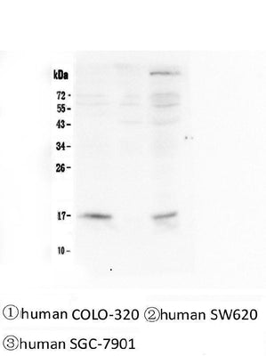 Anti-FHIT Antibody Picoband® (monoclonal, 26H7 Boster Bio