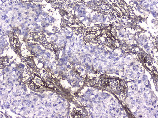 Anti-Collagen IV COL4A1 Antibody Picoband® (monoclonal, 3G3 Boster Bio