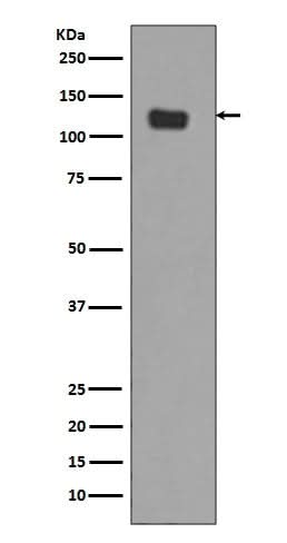 Anti-Integrin alpha 6 ITGA6 Rabbit Monoclonal Antibody Boster Bio