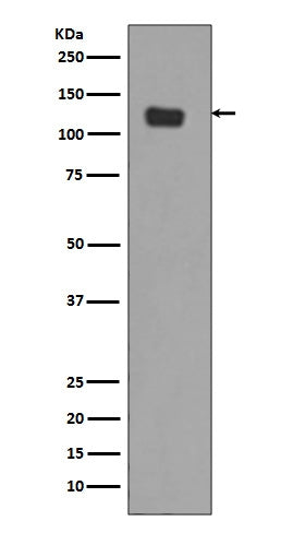 Anti-Integrin alpha 6 ITGA6 Rabbit Monoclonal Antibody Boster Bio