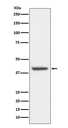 Anti-HDAC8/Histone Deacetylase 8 Rabbit Monoclonal Antibody Boster Bio