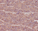 Anti-beta III Tubulin TUBB3 Rabbit Monoclonal Antibody Boster Bio