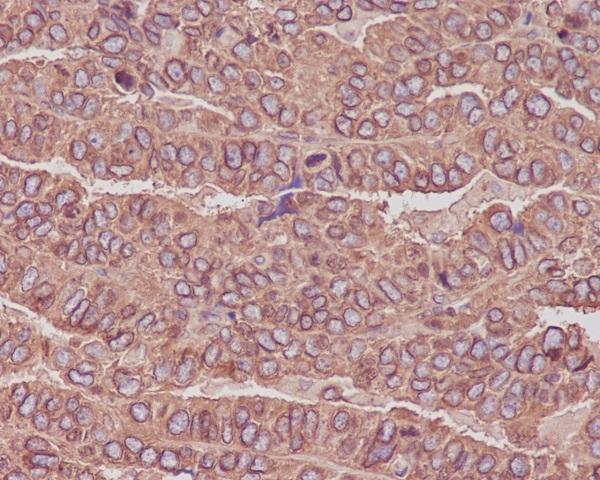 Anti-beta III Tubulin TUBB3 Rabbit Monoclonal Antibody Boster Bio