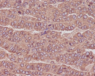 Anti-beta III Tubulin TUBB3 Rabbit Monoclonal Antibody Boster Bio