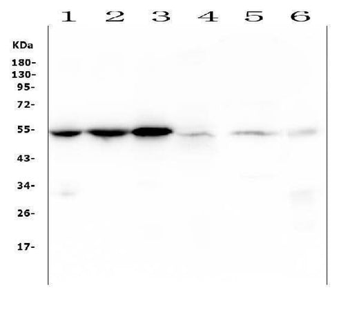 Anti-Desmin Antibody Picoband® (monoclonal, 2B5 Boster Bio