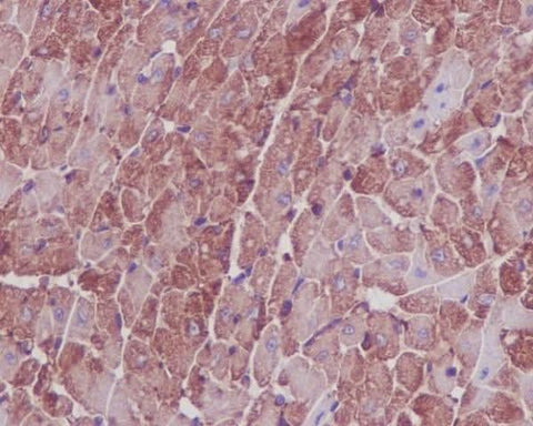 Anti-Actin ACTA1 Rabbit Monoclonal Antibody Boster Bio