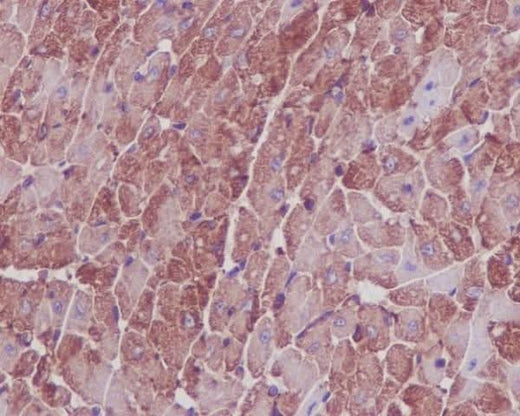 Anti-Actin ACTA1 Rabbit Monoclonal Antibody Boster Bio