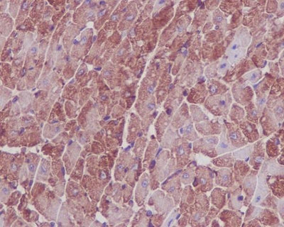Anti-Actin ACTA1 Rabbit Monoclonal Antibody Boster Bio