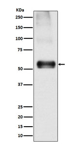 Anti-EAAT1 SLC1A3 Rabbit Monoclonal Antibody Boster Bio