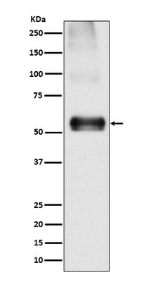 Anti-EAAT1 SLC1A3 Rabbit Monoclonal Antibody Boster Bio