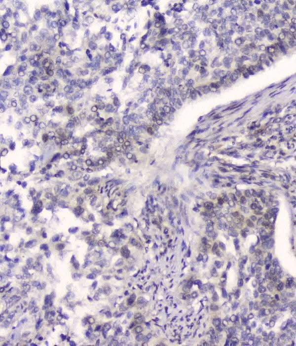 Anti-HSPA2 Antibody Picoband® (monoclonal, 4A4 Boster Bio
