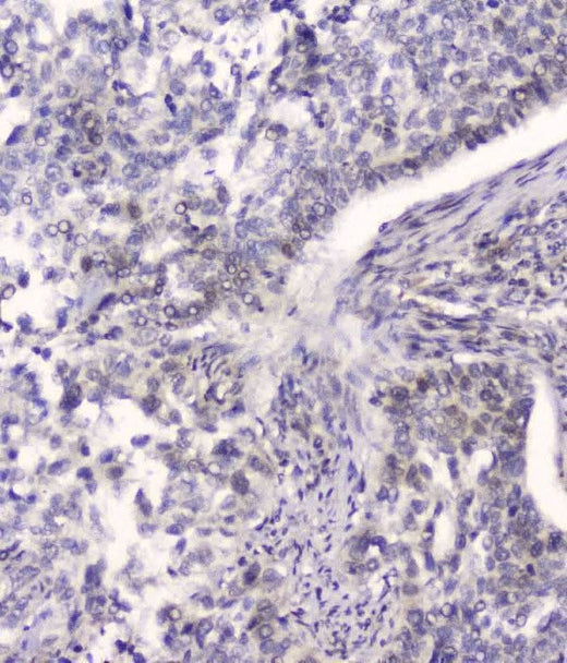 Anti-HSPA2 Antibody Picoband® (monoclonal, 4A4 Boster Bio