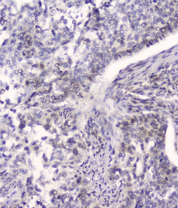 Anti-HSPA2 Antibody Picoband® (monoclonal, 4A4 Boster Bio