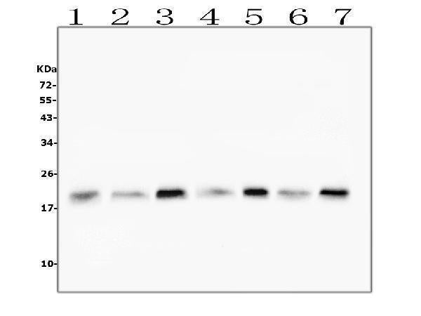 Anti-Cofilin 2/CFL2 Antibody Picoband® (monoclonal, 8C13 Boster Bio