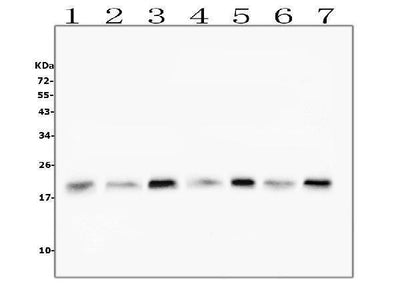 Anti-Cofilin 2/CFL2 Antibody Picoband® (monoclonal, 8C13 Boster Bio