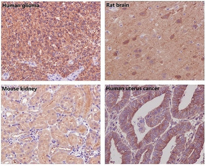 Anti-beta Tubulin TUBB Rabbit Monoclonal Antibody Boster Bio