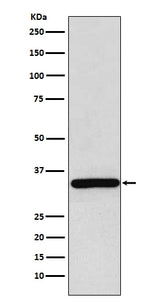 Anti-gamma Sarcoglycan Rabbit Monoclonal Antibody Boster Bio