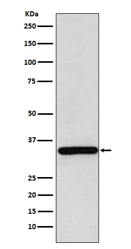 Anti-gamma Sarcoglycan Rabbit Monoclonal Antibody Boster Bio