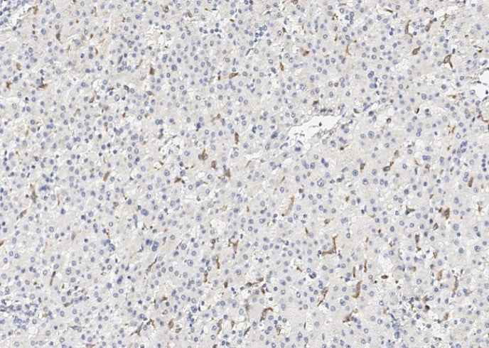 Anti-Human CD163 Antibody [A907] - ABMIUM
