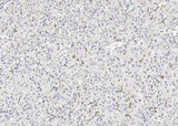 Anti-Human CD163 Antibody [A907] - ABMIUM