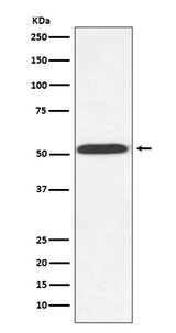 Anti-alpha Tubulin (yeast) TUB1 Rabbit Monoclonal Antibody Boster Bio