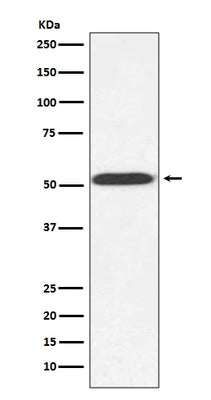 Anti-alpha Tubulin (yeast) TUB1 Rabbit Monoclonal Antibody Boster Bio