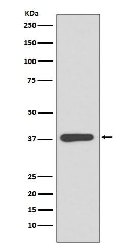 Anti-MBP Rabbit Monoclonal Antibody Boster Bio